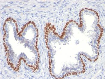 Anti-p63 (Squamous, Basal & Myoepithelial Cell Marker) Monoclonal Antibody(Clone: TP63/11)