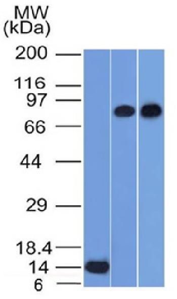 Anti-p63 (Squamous, Basal & Myoepithelial Cell Marker) Monoclonal Antibody(Clone: TP63/1786)