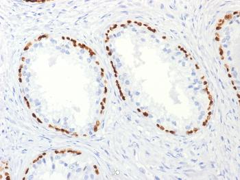 Anti-p63 (Squamous, Basal & Myoepithelial Cell Marker) Monoclonal Antibody(Clone: TP63/2427)