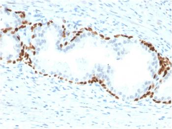 Anti-p63 (Squamous, Basal & Myoepithelial Cell Marker) Monoclonal Antibody(Clone: TP63/2428)