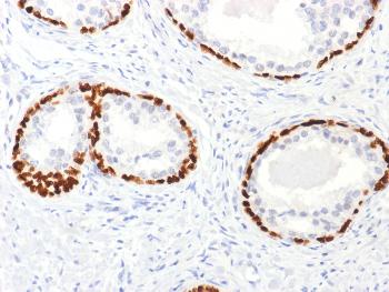 Anti-p63 (Squamous, Basal & Myoepithelial Cell Marker) Polyclonal Antibody