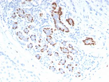 Anti-p40 (deltaNp63) (Squamous, Basal & Myoepithelial Cell Marker) Polyclonal Antibody