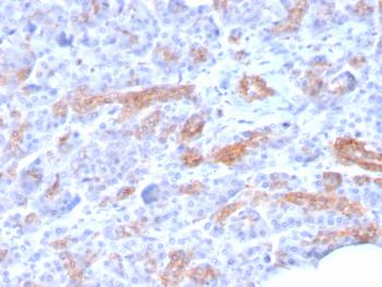 Anti-MRP3 (Multidrµg Resistance-Associated Protein 3) Monoclonal Antibody(Clone: ABCC3/2971)