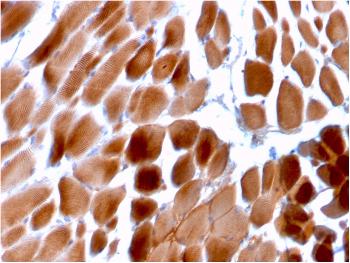 Anti-Sarcomeric Actinin Alpha 2 / ACTN2 Monoclonal Antibody(Clone: ACTN2/3292)