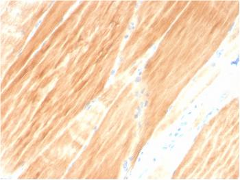 Anti-Sarcomeric Actinin Alpha 2 / ACTN2 Monoclonal Antibody(Clone: ACTN2/3295)