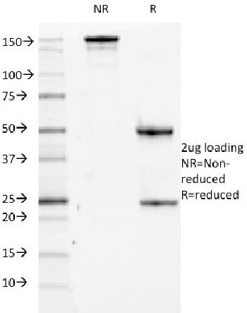 Anti-CD84 / SLAMF5 Monoclonal Antibody(Clone: 152-1D5)