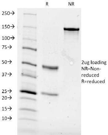 Anti-CD84 / SLAMF5 Monoclonal Antibody(Clone: 153-4D9)