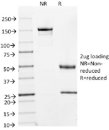 Anti-Cyclin A2 (S- & G2-phase Cyclin) Monoclonal Antibody(Clone: E67)