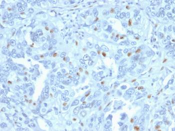 Anti-Cyclin A2 (S- & G2-phase Cyclin) Monoclonal Antibody(Clone: CCNA2/2333)