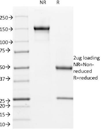 Anti-Cyclin B1 (G2- & M-phase Cyclin) Monoclonal Antibody(Clone: V92.1)