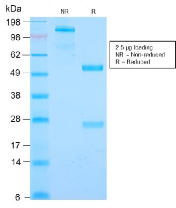 Anti-Cyclin B1 (G2- & M-phase Cyclin) Monoclonal Antibody(Clone: CCNB1/2978R)(Discontinued)