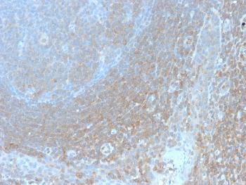 Anti-BCL10 (MALT-Lymphoma Marker) Monoclonal Antibody(Clone: BL10/2988R)