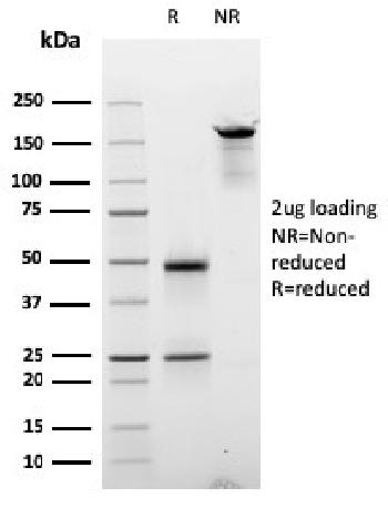 Anti-Cyclin E (G1/S-Phase Cyclin) Monoclonal Antibody(Clone: CCNE1/2587)