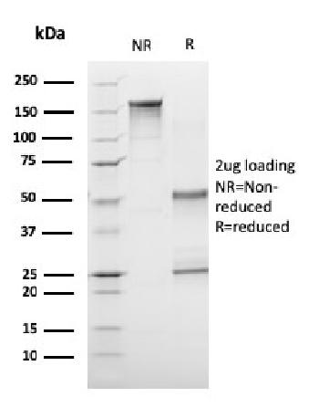 Anti-CD1a / HTA1 (Mature Langerhans Cells Marker) Monoclonal Antibody(Clone: C1A/3249)