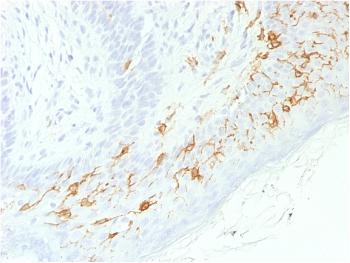 Anti-CD1a / HTA1 (Mature Langerhans Cells Marker) Monoclonal Antibody(Clone: C1A/1506R)