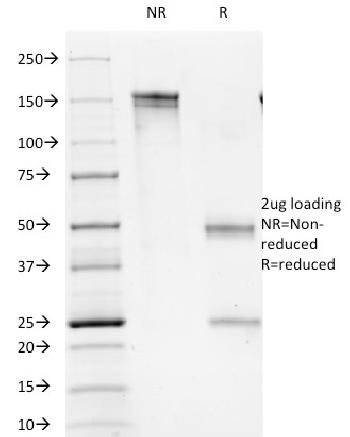 Anti-CD1b (T-Cell Surface Glycoprotein) Monoclonal Antibody(Clone: 100-1A5)