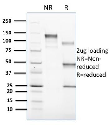 Anti-CD1c Monoclonal Antibody(Clone: CD1C/1603)