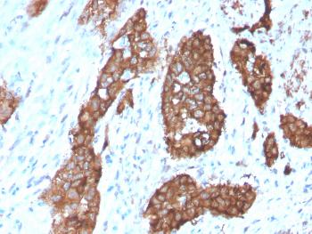 Anti-PDZ and LIM Domain 1 Monoclonal Antibody(Clone: CPTC-PDLIM1-1)