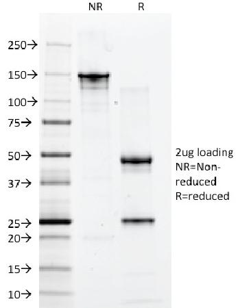 Anti-CD2 / Lymphocyte Function Antigen 2 (LFA-2) Monoclonal Antibody(Clone: 1E7E8.G4)