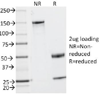 Anti-CD2 / Lymphocyte Function Antigen 2 (LFA-2) Monoclonal Antibody(Clone: UMCD2)