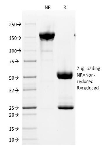 Anti-CD2 / Lymphocyte Function Antigen 2 (LFA-2) Monoclonal Antibody(Clone: HuLy-m1)