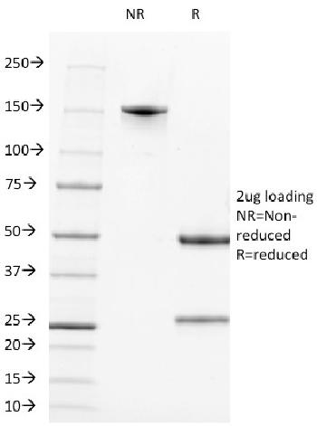 Anti-CD2 / Lymphocyte Function Antigen 2 (LFA-2) Monoclonal Antibody(Clone: LFA2/600)