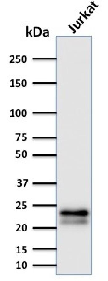 Anti-CD3e (T-Cell Marker) Monoclonal Antibody(Clone: C3e/2478)