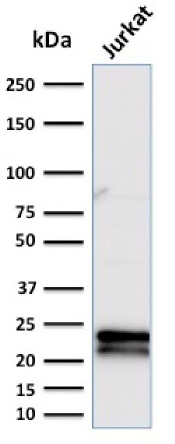 Anti-CD3e (T-Cell Marker) Monoclonal Antibody(Clone: C3e/2479)