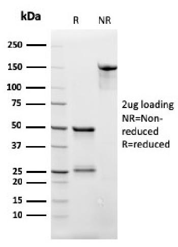 Anti-CD3e (T-Cell Marker) Monoclonal Antibody(Clone: rC3e/2479)