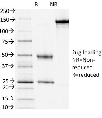 Anti-CD3e (T-Cell Marker) Monoclonal Antibody(Clone: OKT3)