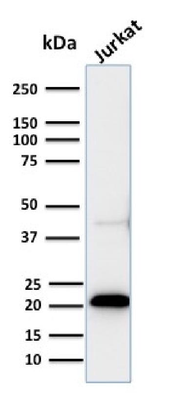 Anti-CD3e (T-Cell Marker) Monoclonal Antibody(Clone: C3e/2858R)