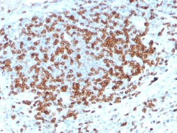 Anti-CD3e (T-Cell Marker) Monoclonal Antibody(Clone: C3e/3125R)