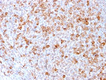 Anti-CD3e (T-Cell Marker) Monoclonal Antibody(Clone: C3e/3171R)