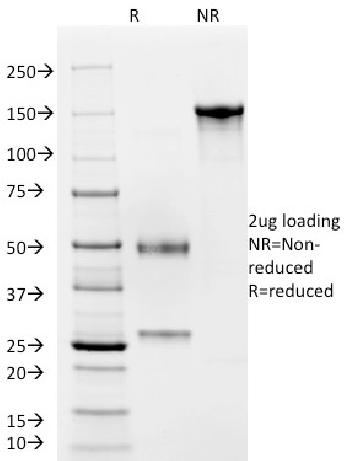 Anti-CD4 (T-Helper/Inducer Cell Marker) Monoclonal Antibody(Clone: C4/206)