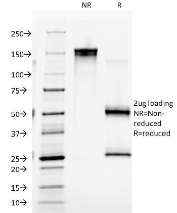 Anti-CD4 (T-Helper/Inducer Cell Marker) Monoclonal Antibody(Clone: EDU-2)