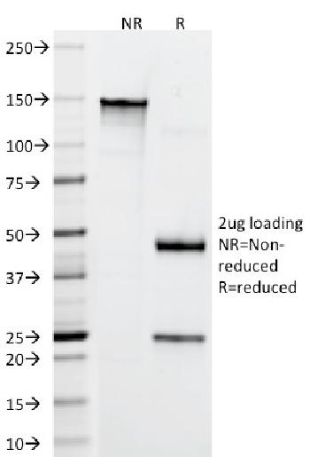 Anti-CD4 (T-Helper/Inducer Cell Marker) Monoclonal Antibody(Clone: RIV7)