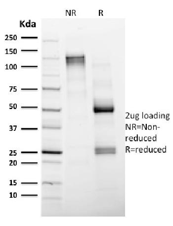 Anti-CD4 (T-Helper/Inducer Cell Marker) Monoclonal Antibody(Clone: CD4/1604)