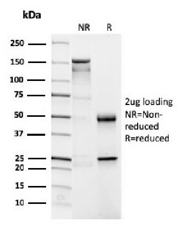 Anti-CD4 (T-Helper/Inducer Cell Marker) Monoclonal Antibody(Clone: CD4/3026)