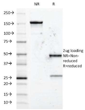 Anti-CD5 (Mantle Cell Lymphoma Marker) Monoclonal Antibody(Clone: B-B8)