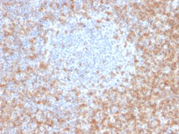 Anti-CD5 (Mantle Cell Lymphoma Marker) Monoclonal Antibody(Clone: CD5/2416)