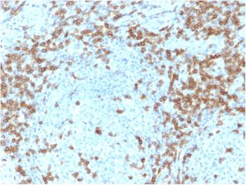 Anti-CD5 (Mantle Cell Lymphoma Marker) Monoclonal Antibody(Clone: CD5/2418)