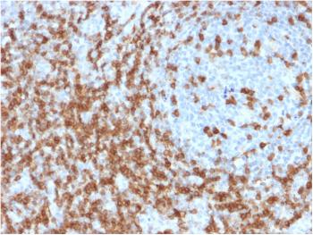 Anti-CD5 (Mantle Cell Lymphoma Marker) Monoclonal Antibody(Clone: CD5/2419)