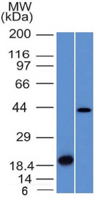 Anti-Aurora B (Proliferation Marker) Monoclonal Antibody(Clone: AURKB/1521)