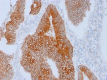 Anti-Aurora B (Proliferation Marker) Monoclonal Antibody(Clone: AURKB/1592)