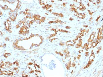 Anti-Aurora B (Proliferation Marker) Monoclonal Antibody(Clone: AURKB/1593)