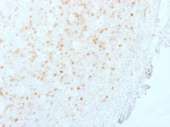 Anti-Aurora B (Proliferation Marker) Monoclonal Antibody(Clone: AURKB/1845)