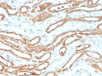 Anti-Aurora B (Proliferation Marker) Monoclonal Antibody(Clone: rAURKB/1592)