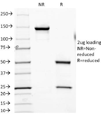 Anti-CD6 (Negative Marker of T-regulatory Cells) Monoclonal Antibody(Clone: SPV-L14)