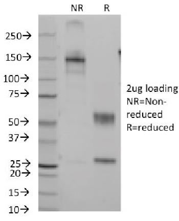 Anti-CD7 (T-Cell Leukemia Marker) Monoclonal Antibody(Clone: B-F12)