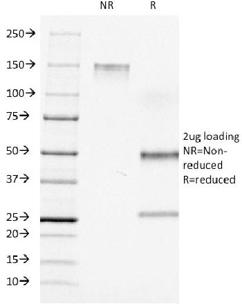 Anti-CD7 (T-Cell Leukemia Marker) Monoclonal Antibody(Clone: C7/511)